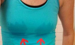 Причины и лечение неприятного запаха между грудными железами
