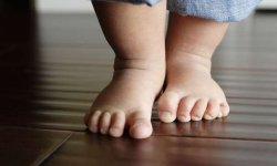 Причины, виды, профилактика и лечение потницы на ногах у ребенка